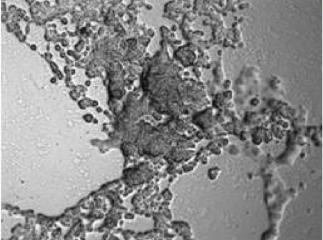 Intracellular Delivery of Peptide